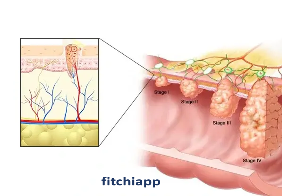 9 نکته حیاتی که باید درباره زگیل تناسلی (HPV) و راه‌های مقابله با آن بدانید