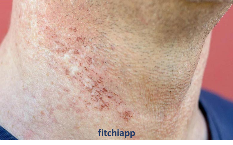 آیا لیزر زیر بغل و بیکینی خطرناک است؟ بررسی 4 شایعه و واقعیت علمی